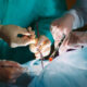 Chirurghi durante un trapianto - trapianti